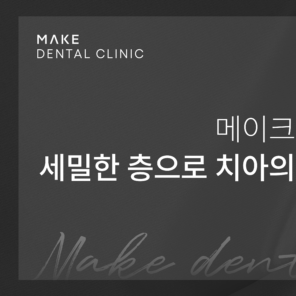 자연치아를 살리는 선택, 치아 삭제를 줄인 논현동라미네이트 관련 이미지 16