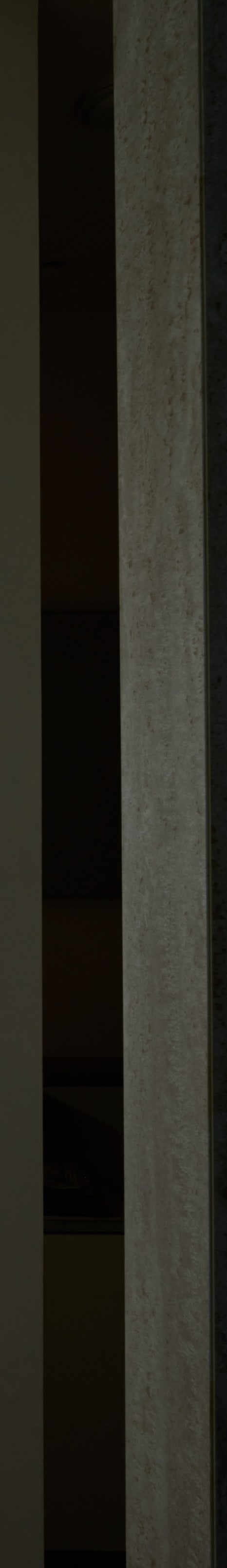 강남신사역치과, 건강한 치아 위에 완성되는 아름다움 관련 이미지 28