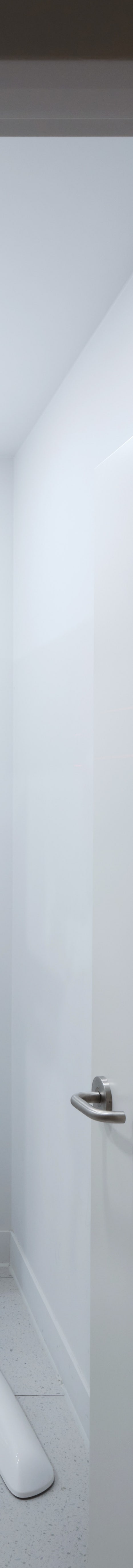 토끼이빨 라미네이트, 이렇게 자연스러워질 수 있습니다 [+치료 사례 포함] 관련 이미지 27