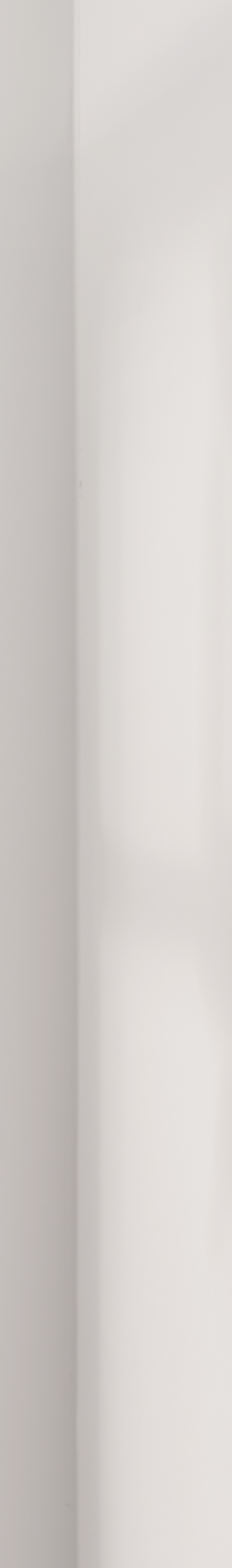 잠원역치과가 선택한 하이엔드 라미네이트, 그 차이가 궁금하다면? 관련 이미지 27