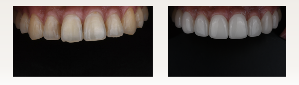 결혼 준비 중인 예비신부라면 꼭 읽어보세요 💍 &mdash; 웨딩 촬영의 완성은 &lsquo;스마일&rsquo;, 예쁘게 웃는 법 관련 이미지 1