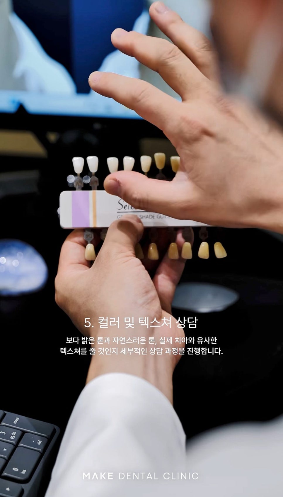 강남논현동치과 라미네이트 재료별 특징과 선택 기준 관련 이미지 2