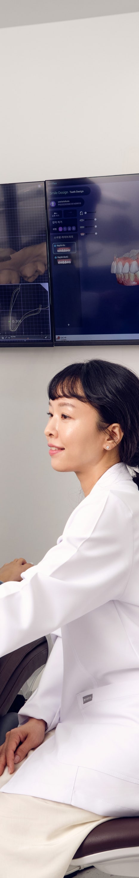 학동역치과 라미네이트, 치아 삭제가 걱정되는 분들께 관련 이미지 16