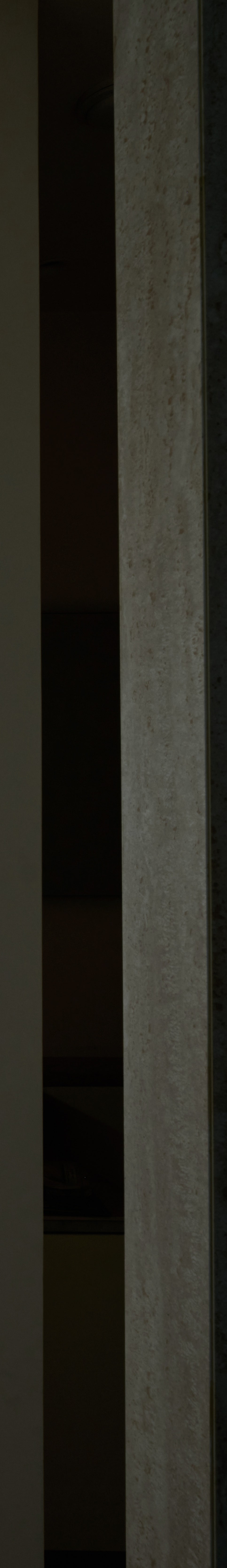 신논현역치과 오래된 치아가 고민이시라면? 관련 이미지 36