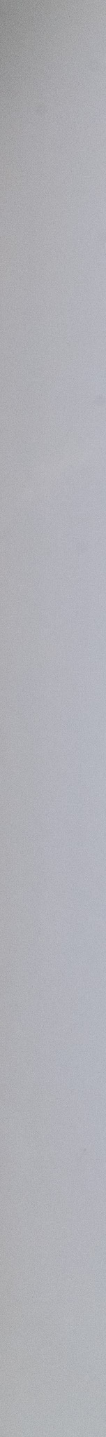 자연치아를 살리는 선택, 치아 삭제를 줄인 논현동라미네이트 관련 이미지 18