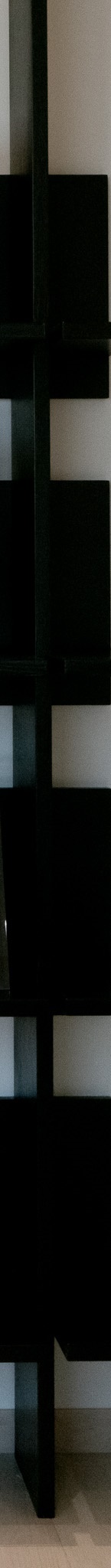 앞니 라미네이트 후기가 좋은 진짜 이유를 알려드립니다 관련 이미지 23