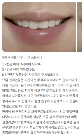 자연스러운 미소와 치아의 아름다움을 높이는 반포역치과 관련 이미지 1