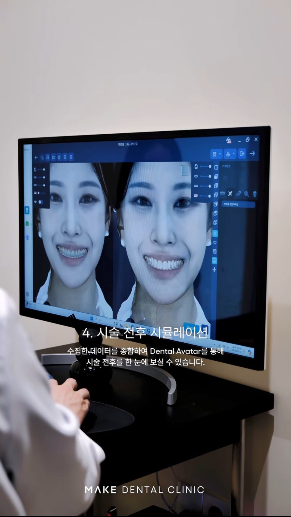 심미치과, 치아와 얼굴의 균형을 맞추다 관련 이미지 7