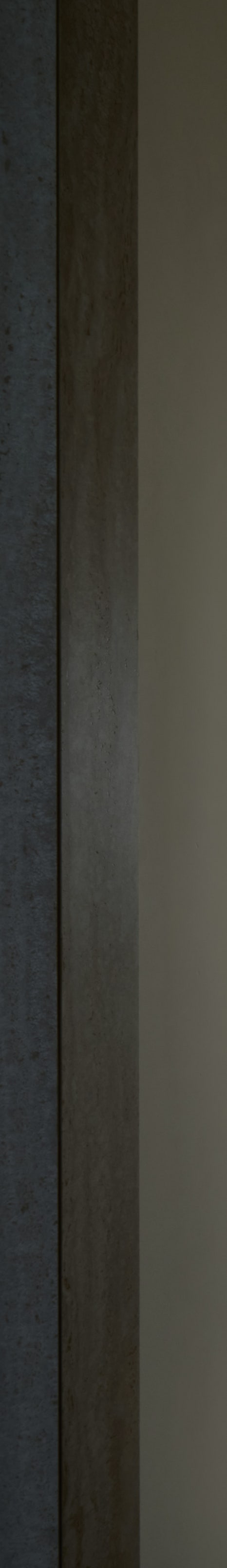 강남신사역치과, 건강한 치아 위에 완성되는 아름다움 관련 이미지 22