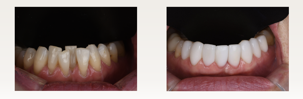 결혼 준비 중인 예비신부라면 꼭 읽어보세요 💍 &mdash; 웨딩 촬영의 완성은 &lsquo;스마일&rsquo;, 예쁘게 웃는 법 관련 이미지 3