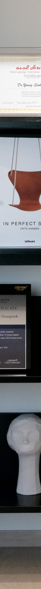 앞니 라미네이트 후기가 좋은 진짜 이유를 알려드립니다 관련 이미지 19