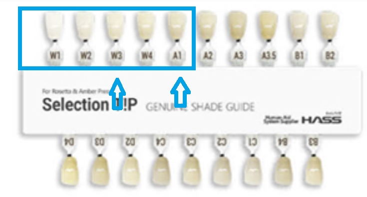 블랙트라이앵글 라미네이트로 완벽한 치아 틈메우기 [ +치료사례 포함] 관련 이미지 11