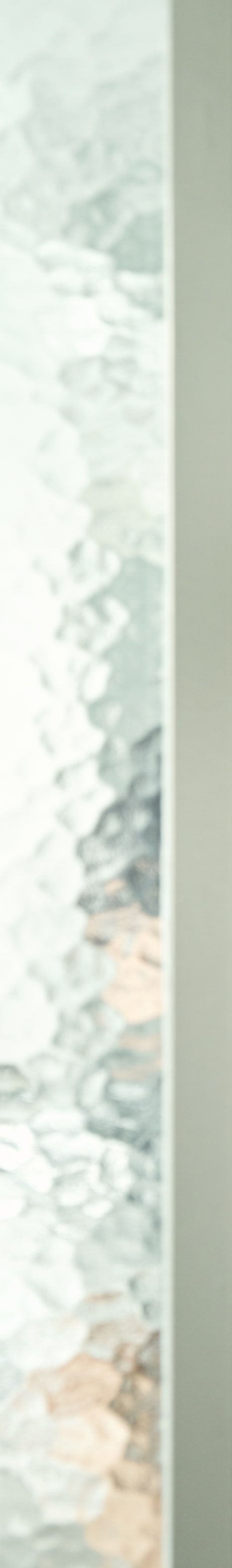 강남신사역치과 라미네이트는 이렇게 진행됩니다 관련 이미지 17