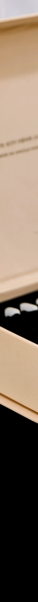 신사역치과추천 3D 프리뷰로 미리 보는 결과 관련 이미지 14