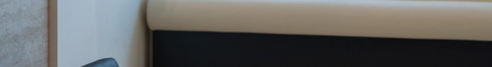 옥니라미네이트, 달라진 미소 [+치료사례 포함] 관련 이미지 31