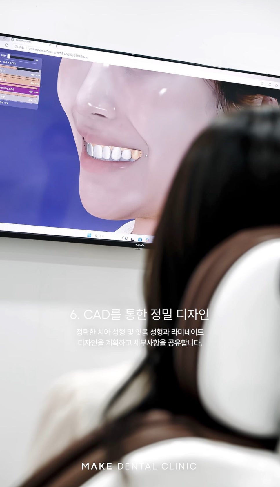 Gangnam Aesthetic Dentistry Starts with Healthy Teeth image 10