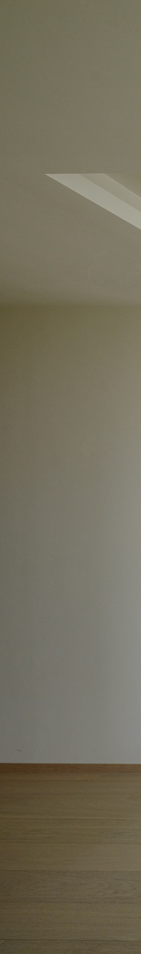 강남논현동치과 라미네이트, 왜 자꾸 떨어질까요? 관련 이미지 12