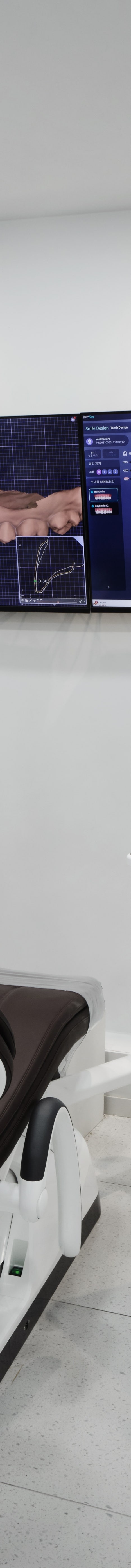 잠원역치과 치아 색&middot;형태&middot;배열까지, 나에게 맞는 심미 치료는? 관련 이미지 20