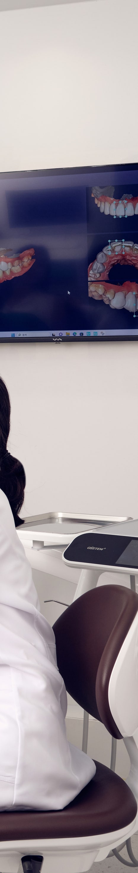 학동역치과 라미네이트, 치아 삭제가 걱정되는 분들께 관련 이미지 17