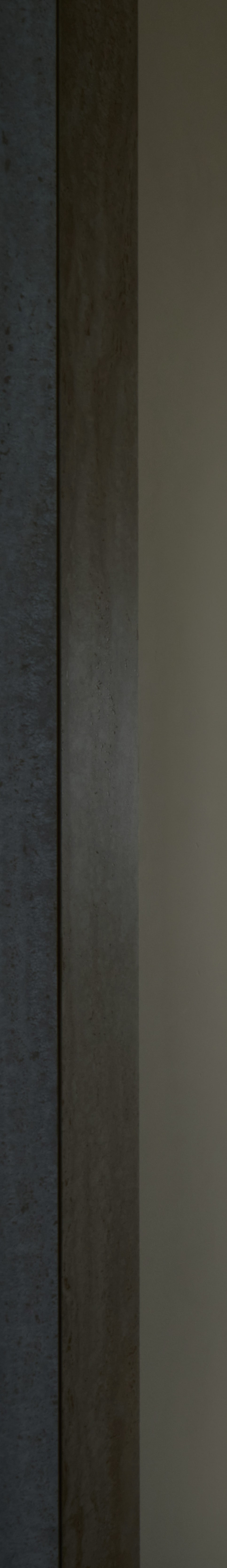 신논현역치과 오래된 치아가 고민이시라면? 관련 이미지 30