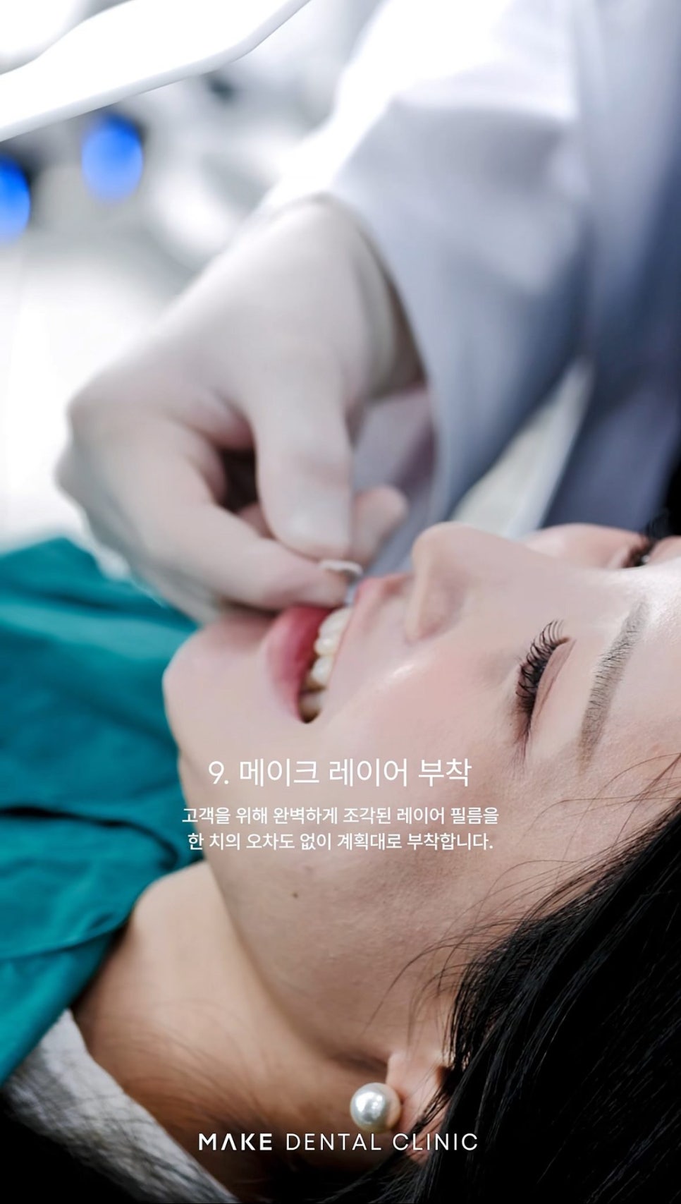 강남신사역치과 라미네이트는 이렇게 진행됩니다 관련 이미지 7