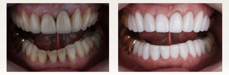 결혼 준비 중인 예비신부라면 꼭 읽어보세요 💍 &mdash; 웨딩 촬영의 완성은 &lsquo;스마일&rsquo;, 예쁘게 웃는 법 관련 이미지 4