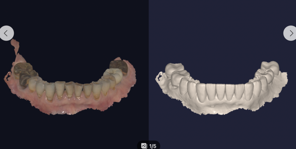 부모님 치아가 걱정된다면 한 번쯤 읽어보세요 — 중년층 구강 변화 이야기 관련 이미지 2