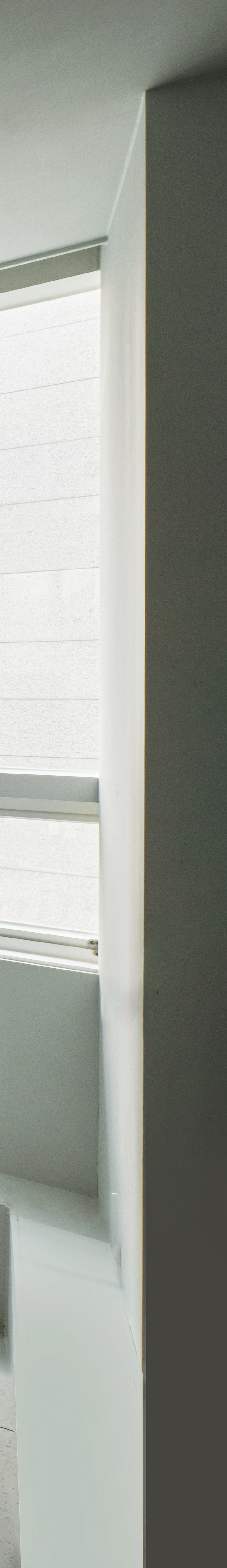 압구정역치과 라미네이트, 이갈이 습관이 있다면 신중하게 관련 이미지 22