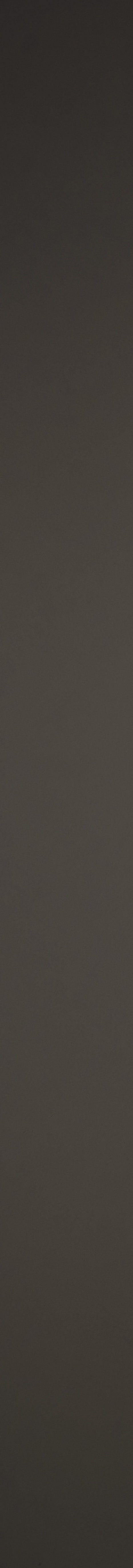 토끼이빨 라미네이트, 이렇게 자연스러워질 수 있습니다 [+치료 사례 포함] 관련 이미지 20