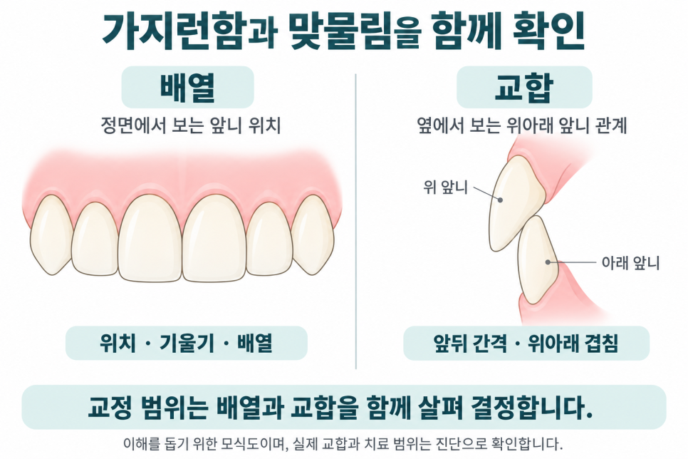 논현동 메이크치과, 전체 교정 말고 앞니만 부분교정할 수도 있나요? 관련 이미지 3