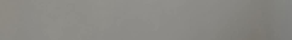 강남구청치과가 말하는 진짜 최소 삭제의 기준 관련 이미지 23