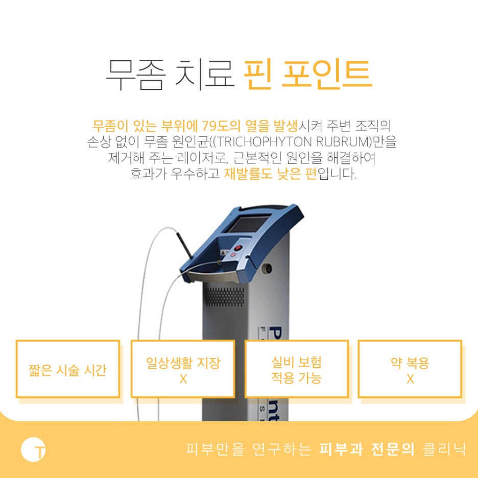 발가락 사이 간지러움 무좀을 의심해 봐야 관련 이미지 4