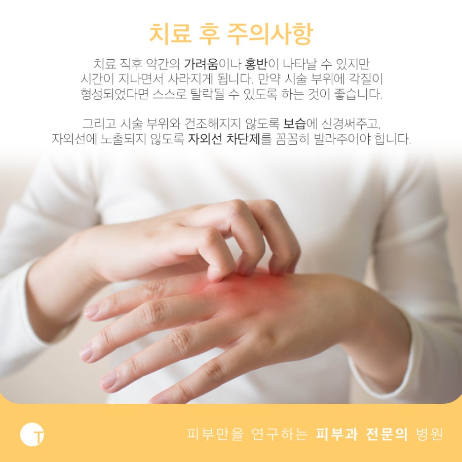 백반증과 건선 치료가 필요하다면 관련 이미지 5