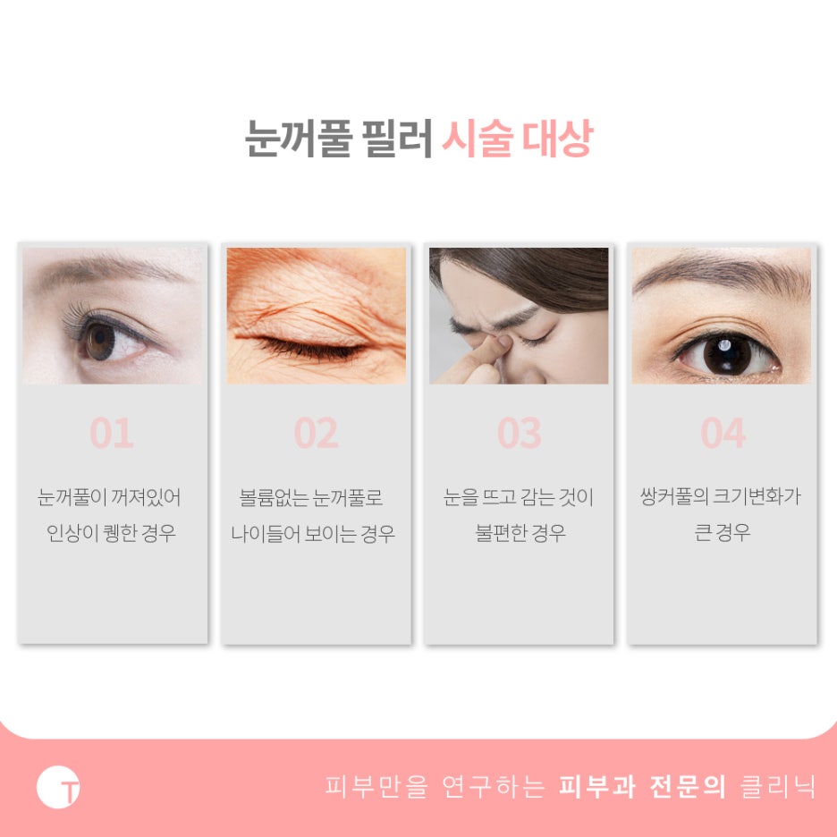 역삼동필러 꺼진 윗눈꺼풀이 고민이라면 관련 이미지 2