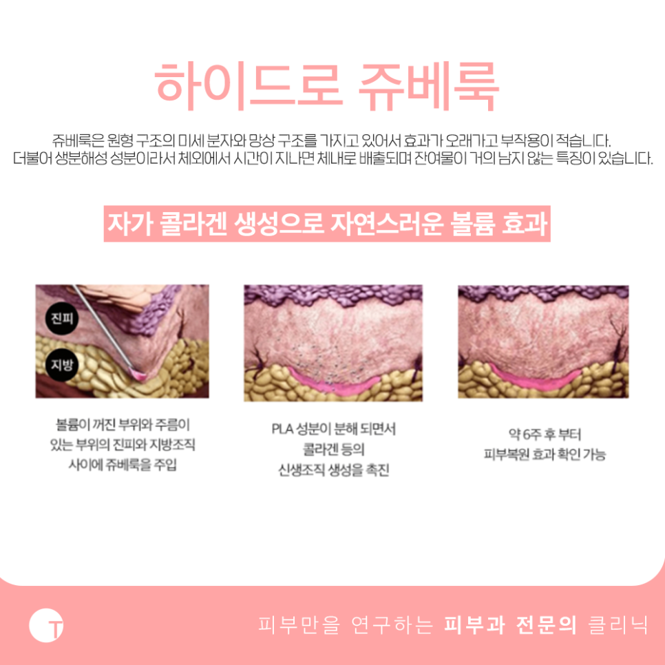 역삼역하이드로쥬베룩 노화에 따른 변화가 있다면 관련 이미지 3