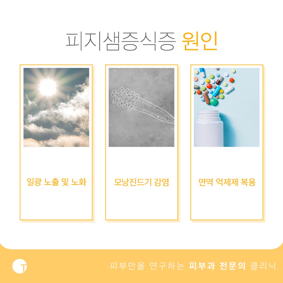 피지샘증식증 증상 어떻게 구분할까 관련 이미지 3