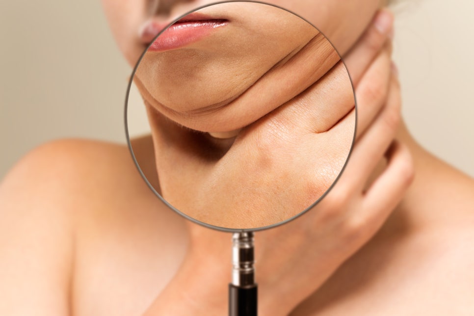 Yeoksam Dermatology Recommendation: If Sagging Skin Is a Concern image 4