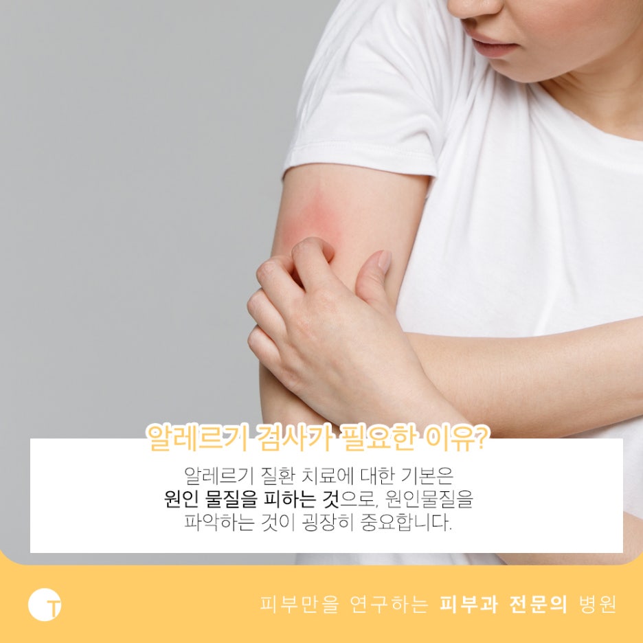 107종 mast 알레르기 검사 한 번의 채혈로 간편하게 관련 이미지 3