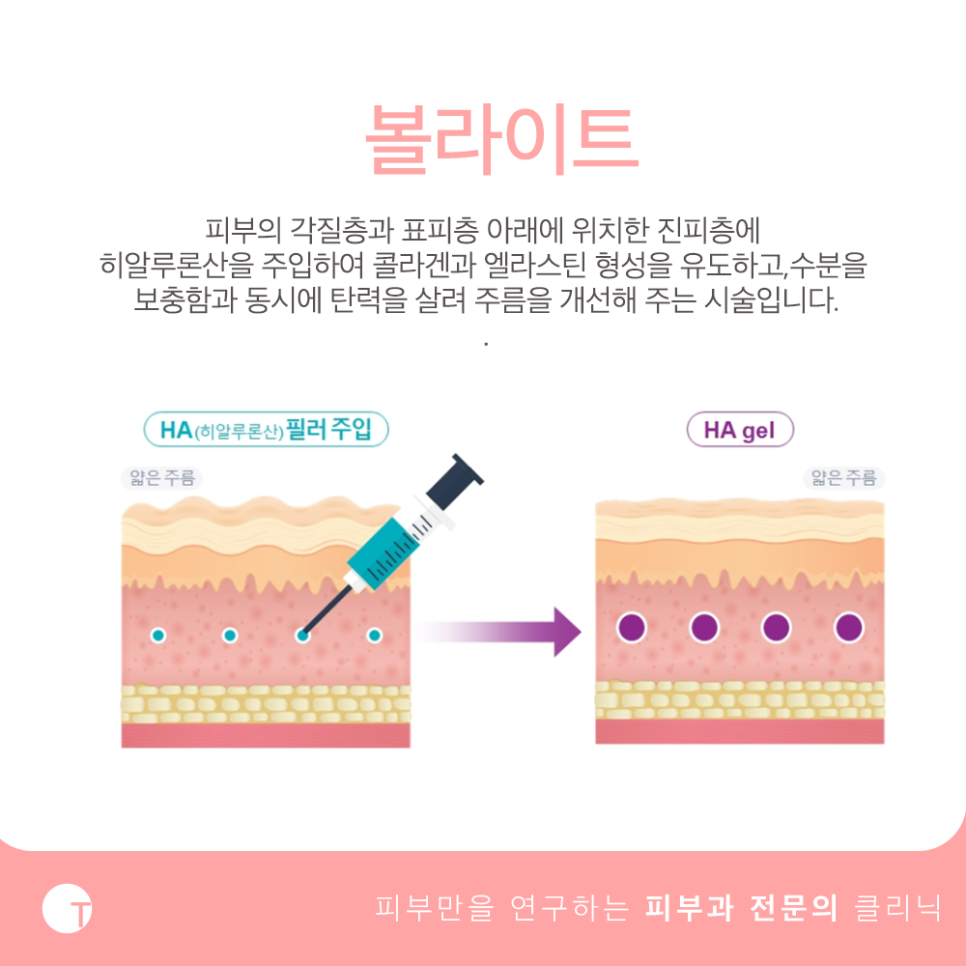 역삼역볼라이트 히알라론산을 주입하여 물광피부로 관련 이미지 3