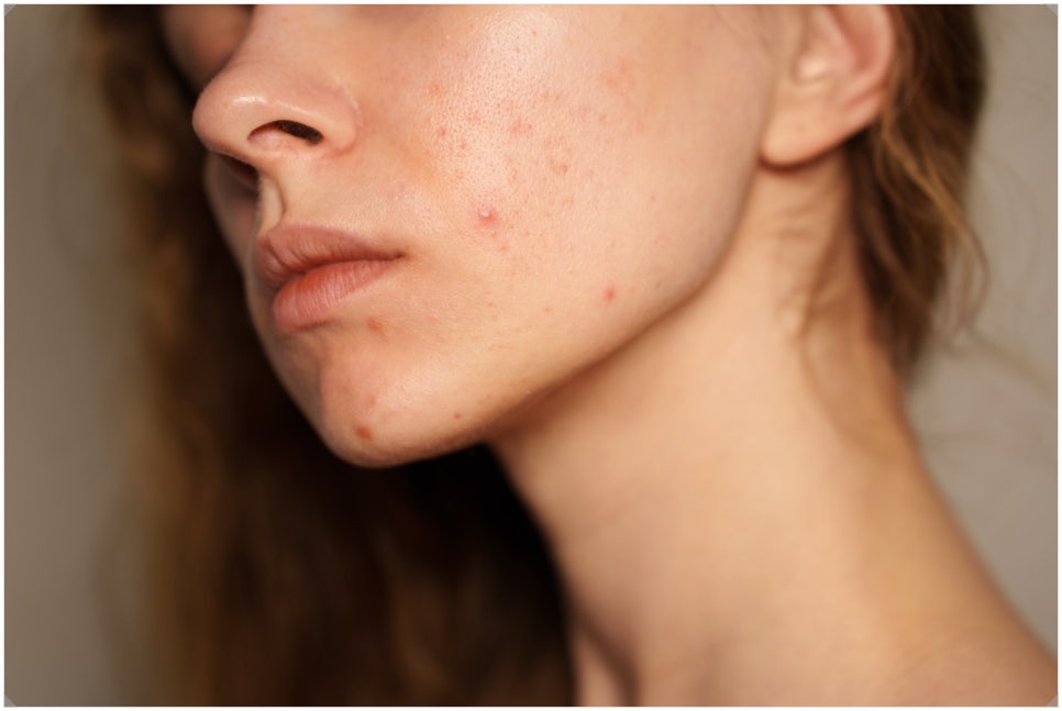 Why a Skin-Condition-Based Approach Matters at a Gangnam Yeoksam Dermatology Clinic image 4