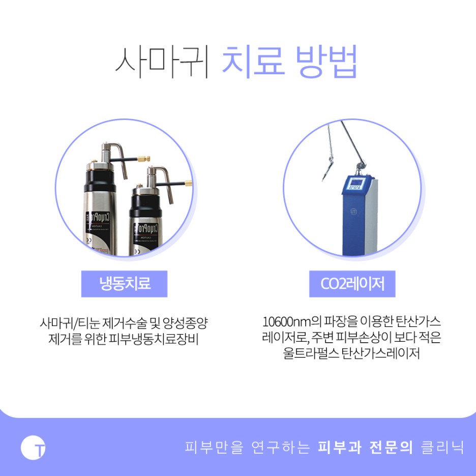 역삼역사마귀치료 확실하게 제거하기 위해서는 관련 이미지 5