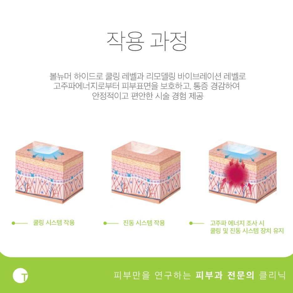 역삼역볼뉴머피부과 개인별로 맞춤형이 가능한 관련 이미지 5