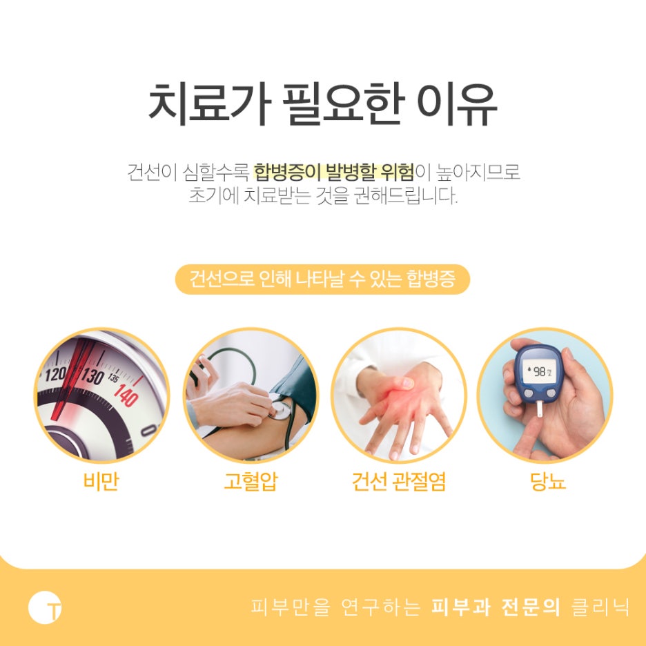건선 팔라스레이저 보험적용이 가능해요 관련 이미지 3