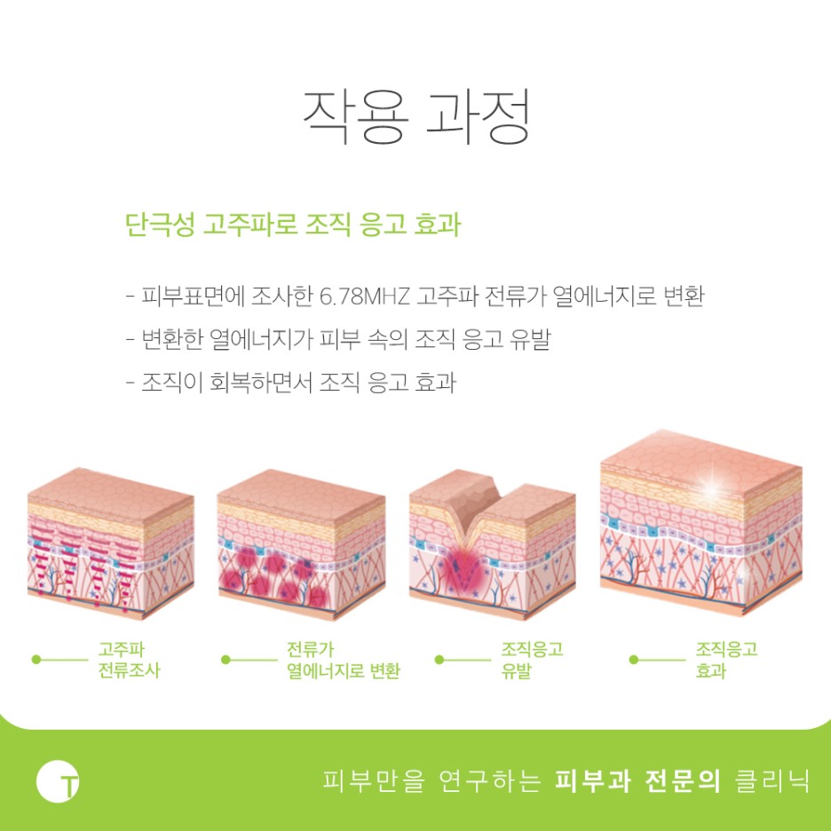 역삼역볼뉴머피부과 개인별로 맞춤형이 가능한 관련 이미지 3