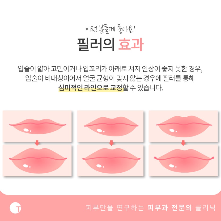 강남입술필러 매력을 상승시키는 관련 이미지 3