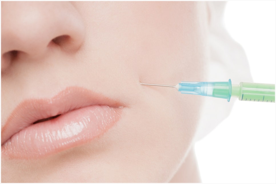 If you Are Considering Yeoksam Juvederm Filler image 6
