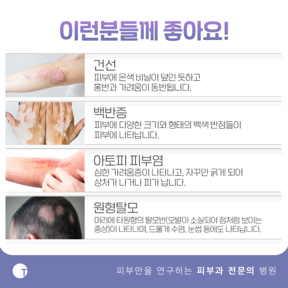역삼동백반증치료 필라스레이저로 관련 이미지 4