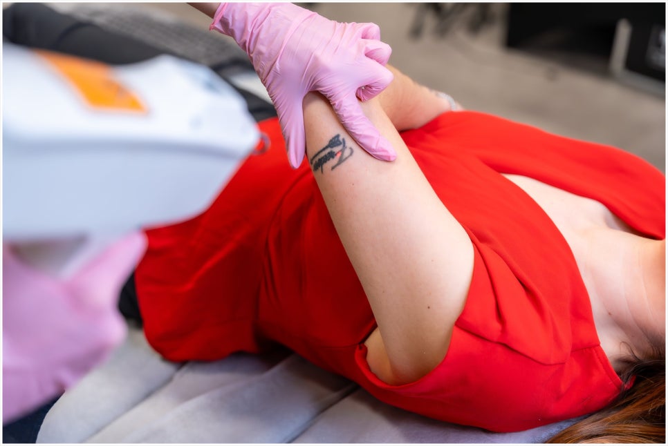 Why You Should Get Tattoo Removal at a Place That Specializes in Gangnam Yeoksam Tattoo Removal image 6