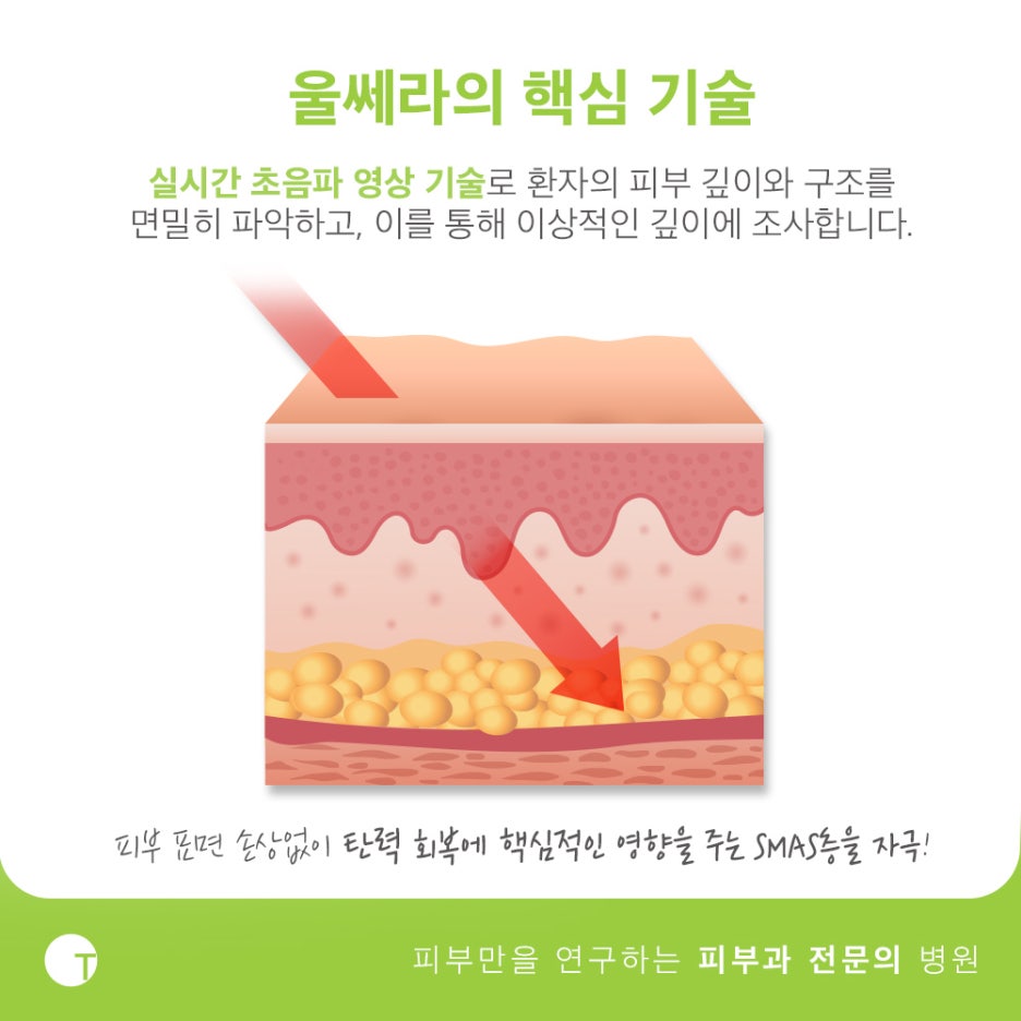 역삼동울쎄라 탄력을 채워드려요 관련 이미지 4