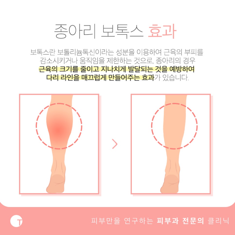 역삼동보톡스 고민되는 부분이 있다면 관련 이미지 2
